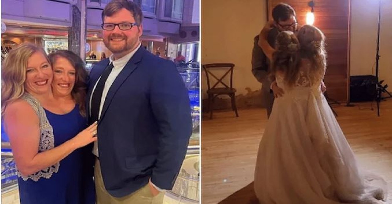 একজনকেই বিয়ে করেছেন জোড়া লাগা ২ বোন