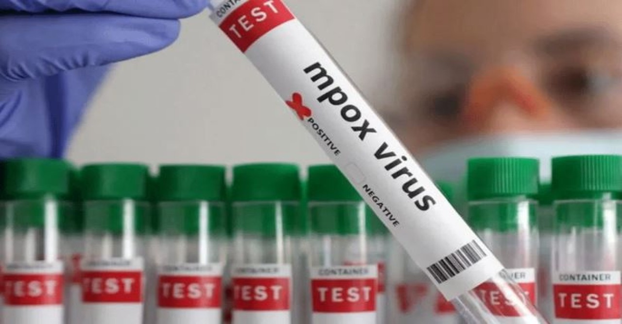 মাঙ্কিপক্স নির্ণয়ের দ্রুত পরীক্ষার অনুমোদন দিল ডব্লিউএইচও